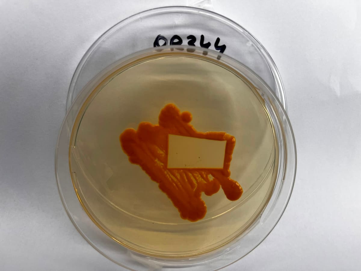 Pigmented bacterial colony